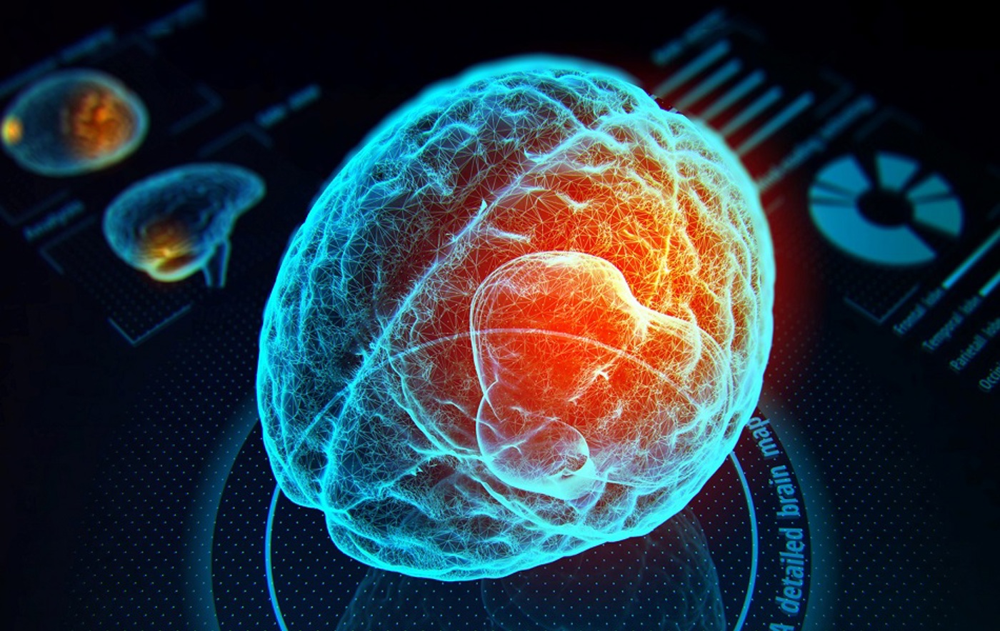 Flyer Brain Image Carousel