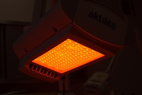 Photodynamic therapy (PDT) Light