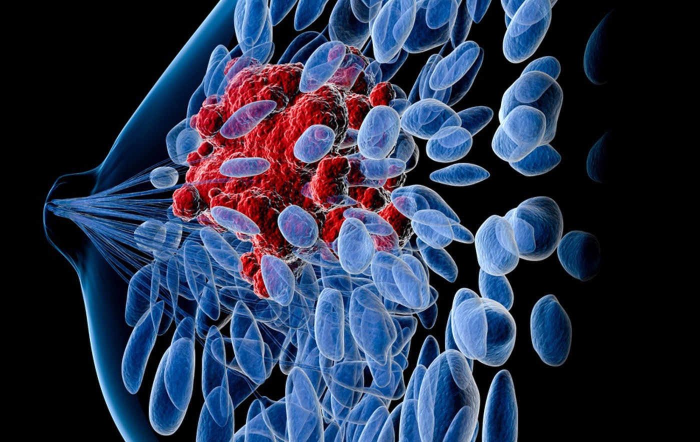 Early Breast Cancer Event Carousel