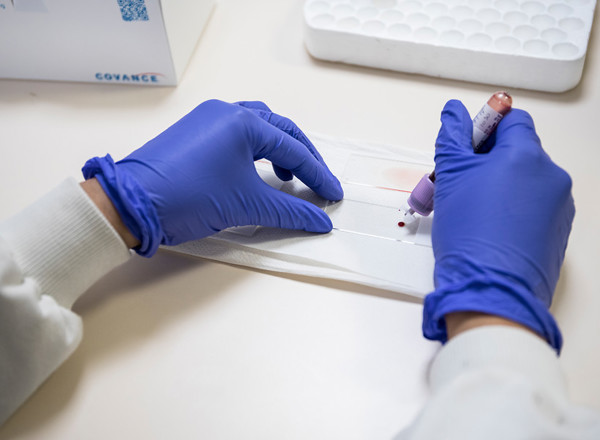 samples, clinical research, laboratory, blood