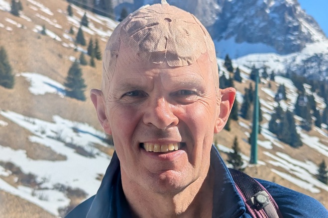 A photo of Christie patient Grant Stobart standing in front of a mountain and wearing an adhesive patch on his head.