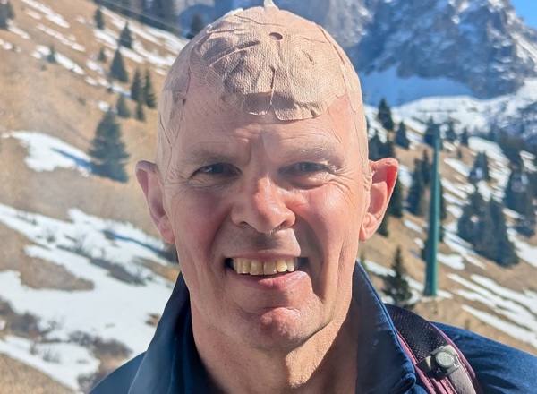 A photo of Christie patient Grant Stobart standing in front of a mountain and wearing an adhesive patch on his head.