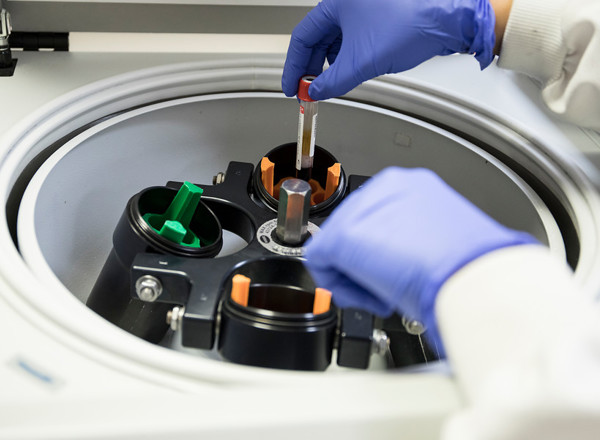 blood, test tube, samples, clinical research, cyclotron, laboratory