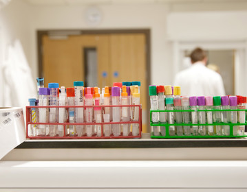 test tube, samples, clinical research, laboratory